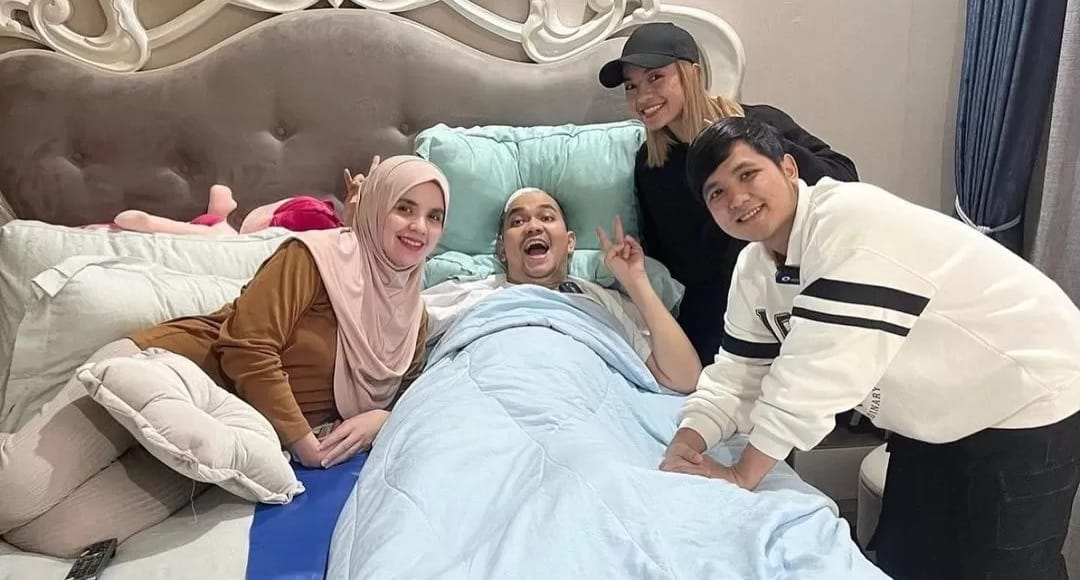 Indra Bekti Jalani Operasi Mata Hari Ini (Foto : Istimewa)