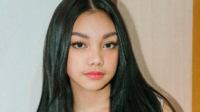 Naura Ayu, Dari Kecil Sering Di-bully Foto : Ist