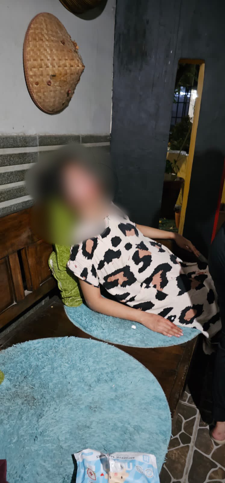 Ibu Muda di Serpong Utara Babak Belur Dipukuli Suaminya, Muka Lebam Hingga Bercucur Darah Seorang wanita berinisial TM (21), babak belur usai dianiaya oleh suaminya sendiri. (tangselpos.id/rmn)