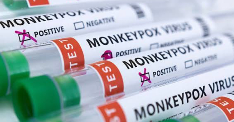 Kemenkes: Total Pasien Monkeypox Kini 8 Orang, Mayoritas Kaum Biseksual Foto : Ist