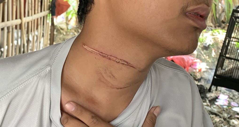 Terjadi Lagi, Pemotor Menjadi Korban Kabel Menjuntai di Bekasi Foto : Ist