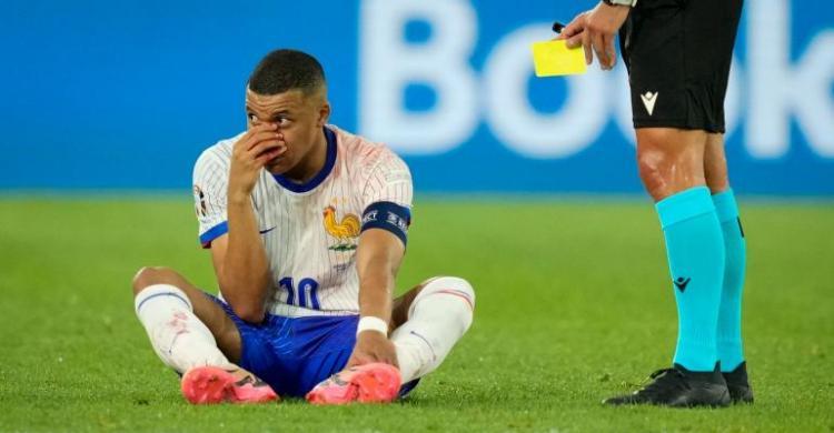 Piala Eropa 2024: Prancis Kurang Menggigit, Mbappe Cidera Skuad Prancis Mbappe cidera hidung nya berdarah. Foto : Ist