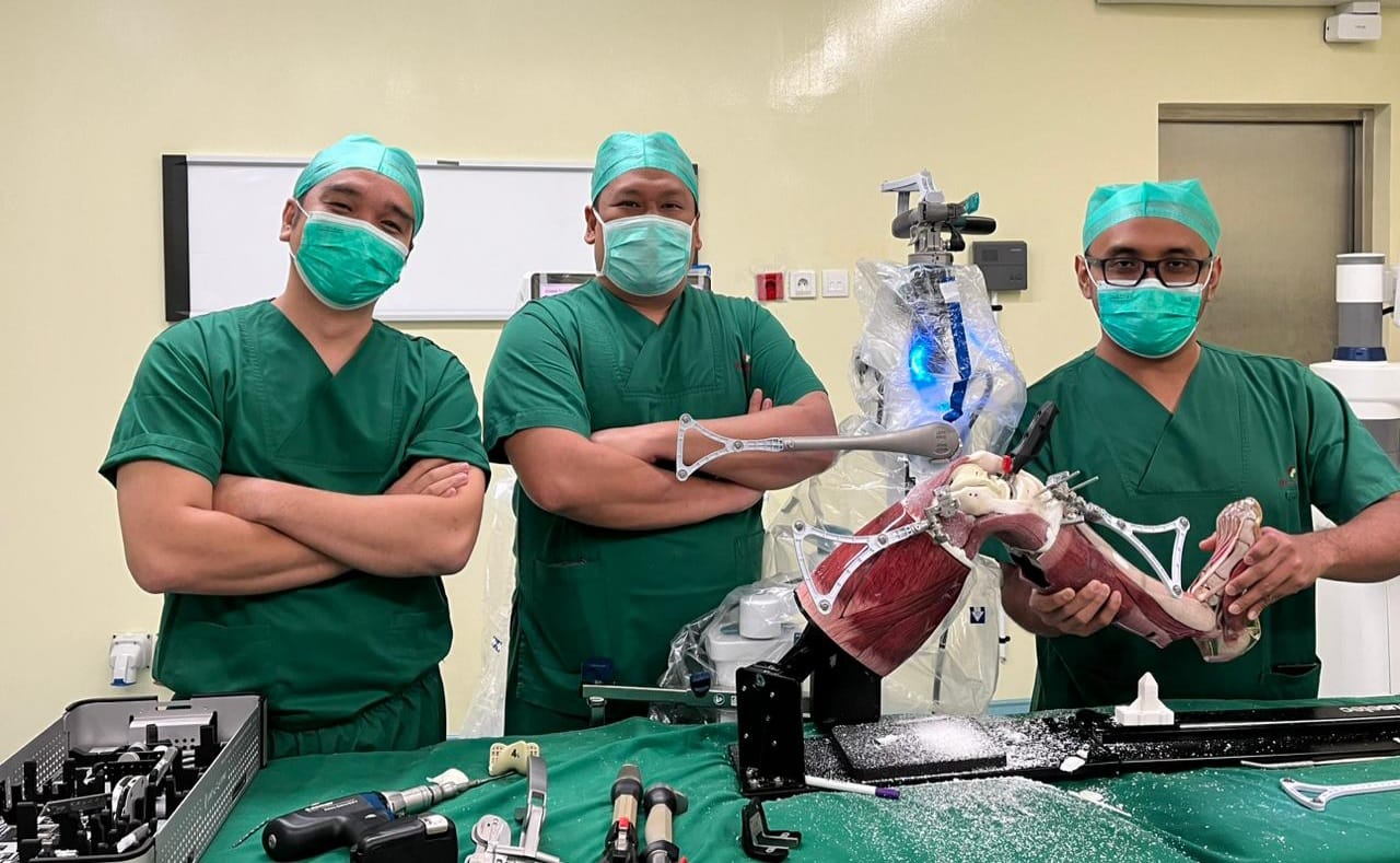 Di Eka Hospital BSD Operasi Penggantian Lutut Hanya 60 Menit Dan Bisa Langsung Berjalan Dokter Eka Hospital saat mempraktekan operasi penggantian lutut dengan menggunakan robotik velys. Foto : Ist