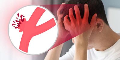 Ilustrasi. Foto : Ist