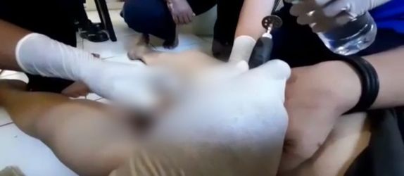 evakuasi pelepasan cincin yang tersangkut di area kemaluan pria asal Cikupa (foto : BPBD Kabupaten Tangerang)