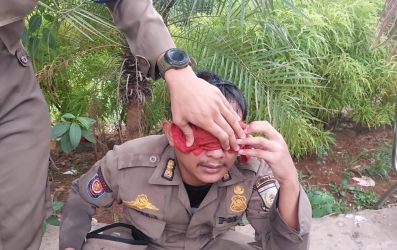 Anggota SatpolPP disiram bensin pada bagian wajahnya hingga mengenai matanya. (tangselpos.id/rmn)
