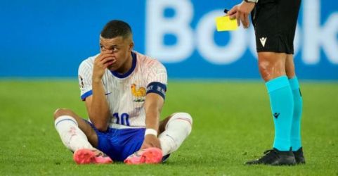 Skuad Prancis Mbappe cidera hidung nya berdarah. Foto : Ist
